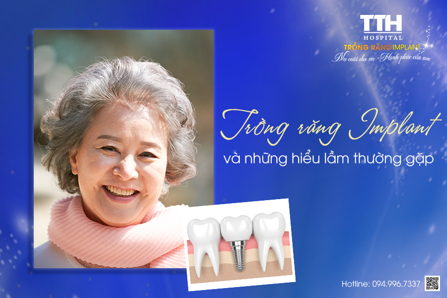 Những hiểu lầm thường gặp về trồng răng Implant